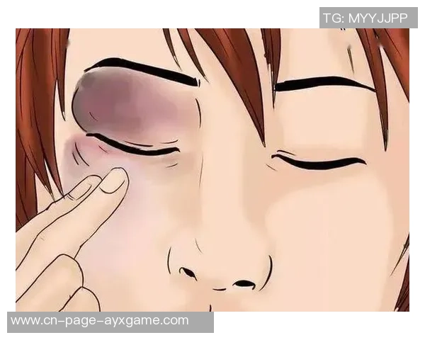 小卡解释鼻子出血原因只是轻微划伤并遭遇眼部意外碰撞